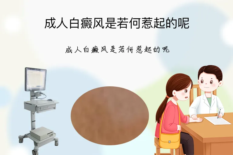 成人白癜风是若何惹起的呢