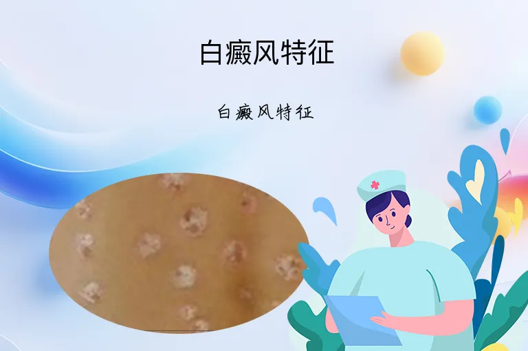 白癜风特征