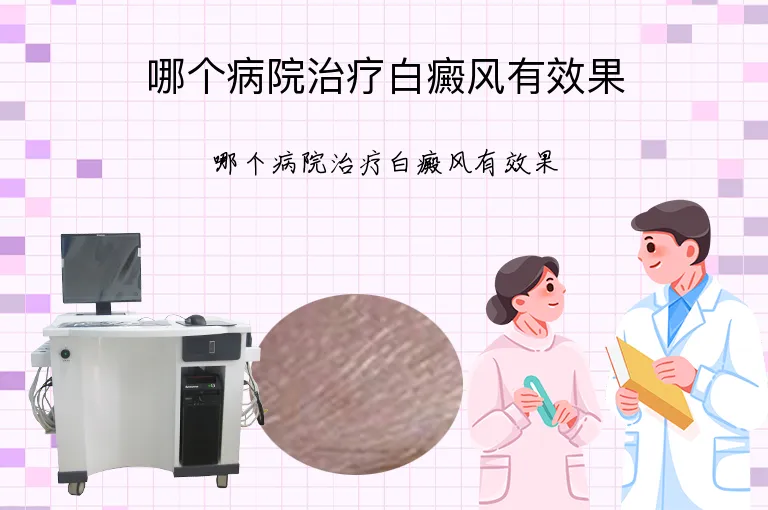 哪个病院治疗白癜风有效果