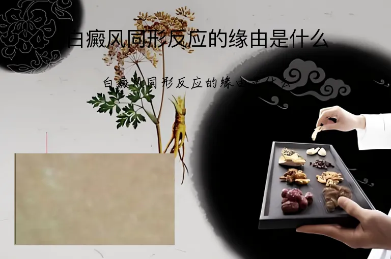 白癜风同形反应的缘由是什么