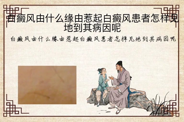 白癜风由什么缘由惹起白癜风患者怎样见地到其病因呢