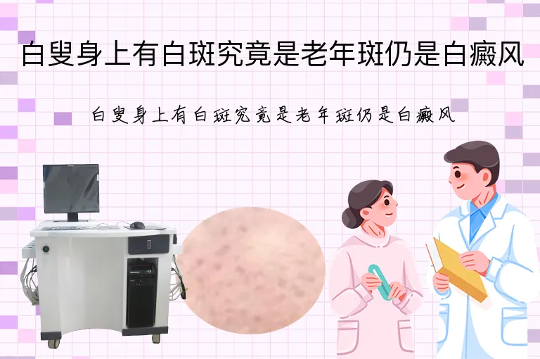 白叟身上有白斑究竟是老年斑仍是白癜风