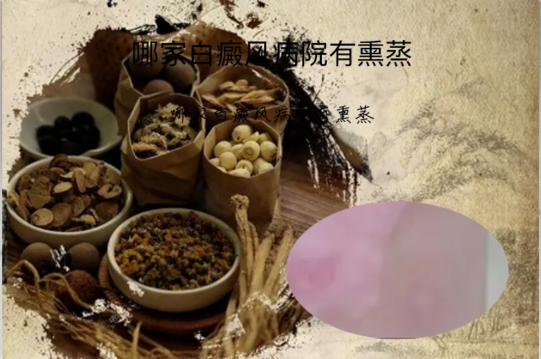 哪家白癜风病院有熏蒸