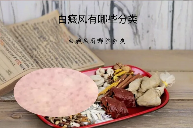 白癜风有哪些分类