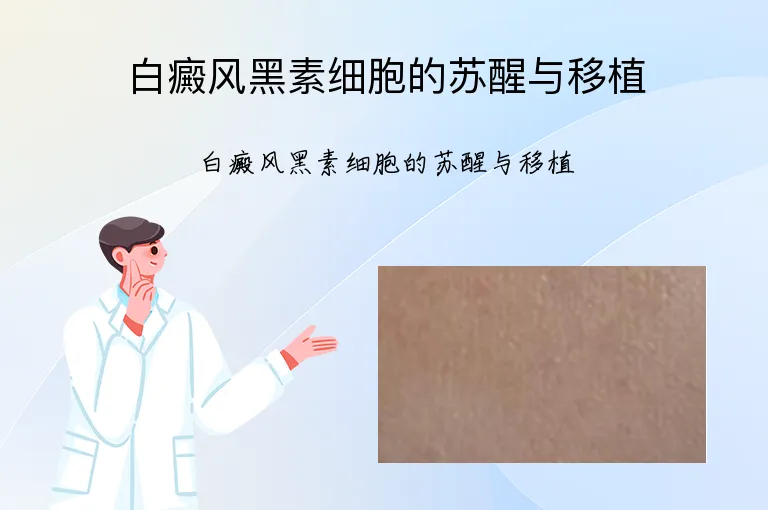 白癜风黑素细胞的苏醒与移植