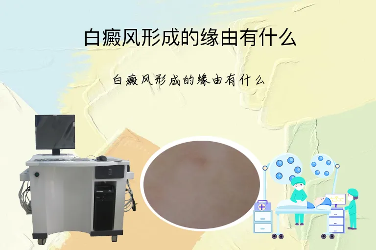 白癜风形成的缘由有什么