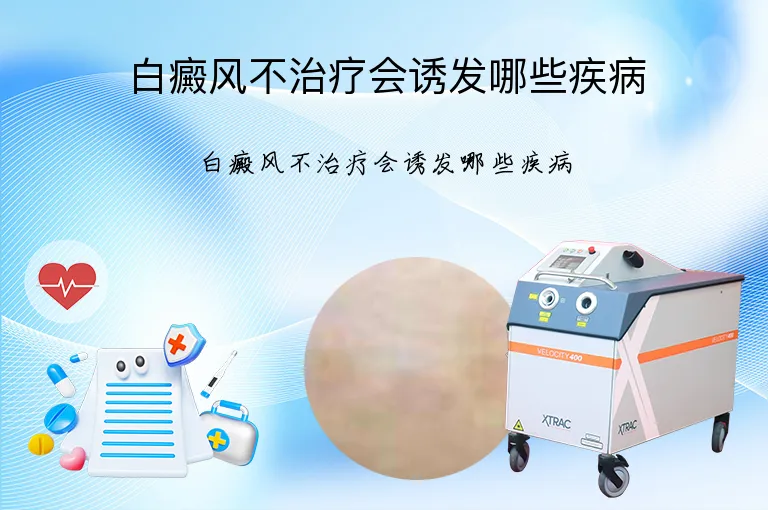 白癜风不治疗会诱发哪些疾病