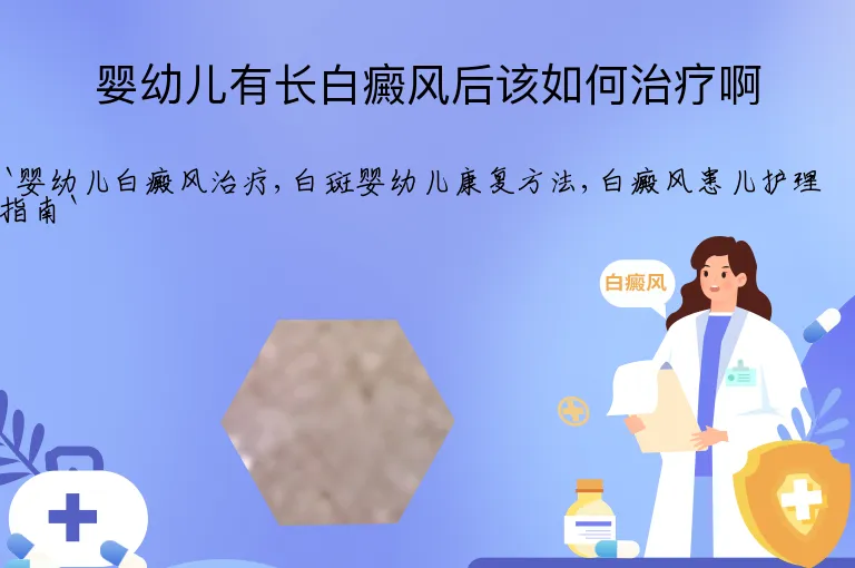婴幼儿有长白癜风后该如何治疗啊