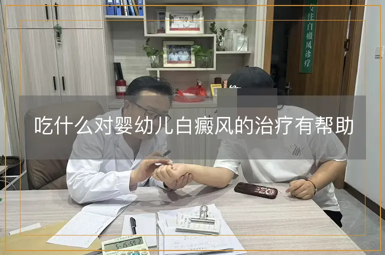 吃什么对婴幼儿白癜风的治疗有帮助