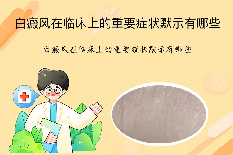 白癜风在临床上的重要症状默示有哪些