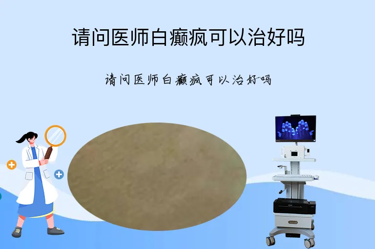 请问医师白癫疯可以治好吗
