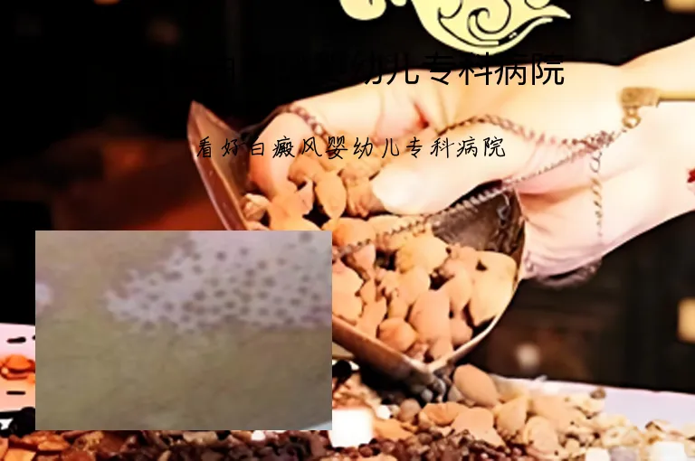 看好白癜风婴幼儿专科病院