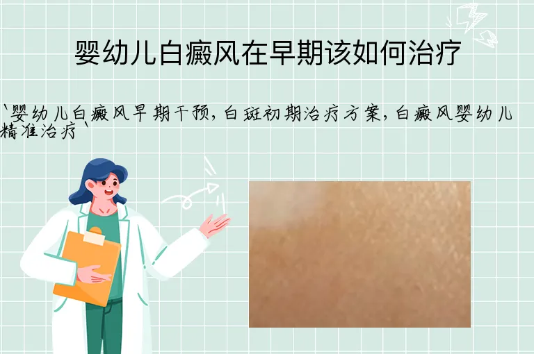 婴幼儿白癜风在早期该如何治疗