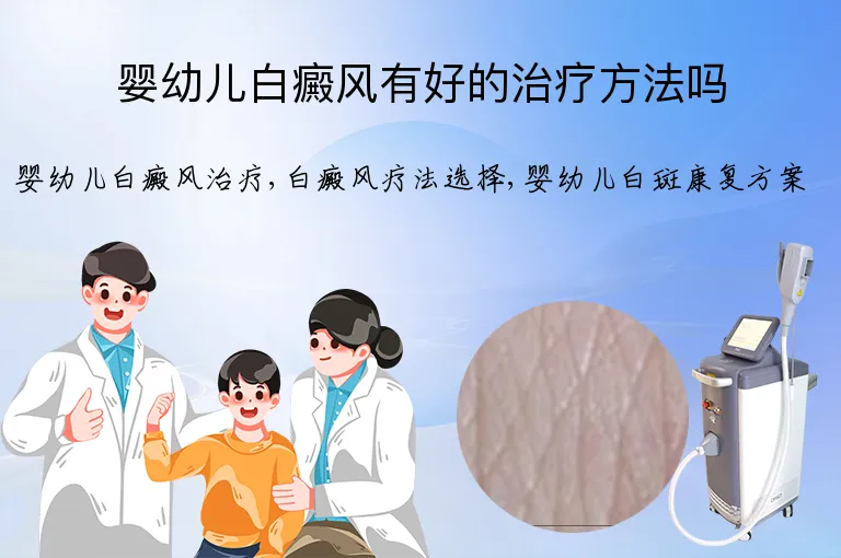 婴幼儿白癜风有好的治疗方法吗