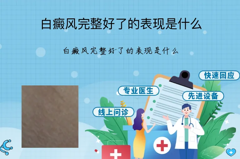 白癜风完整好了的表现是什么