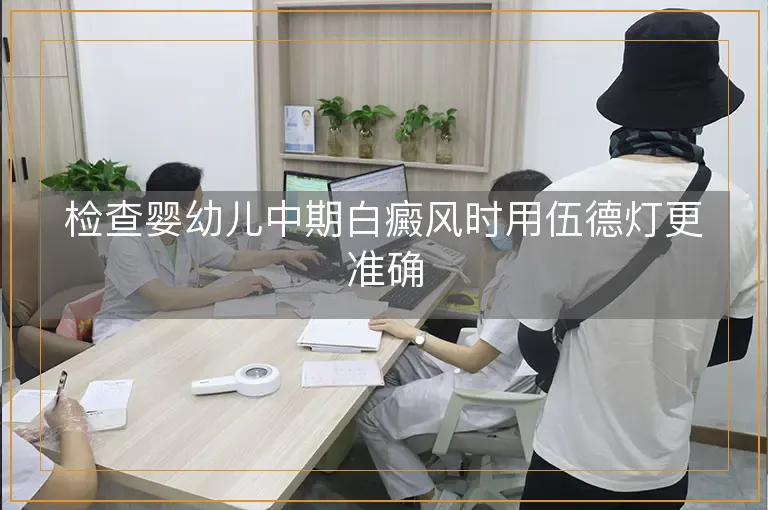 检查婴幼儿中期白癜风时用伍德灯更准确