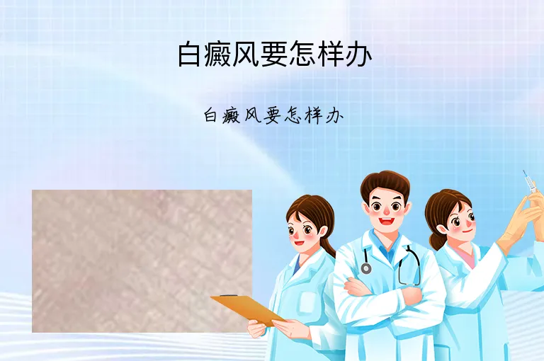 白癜风要怎样办