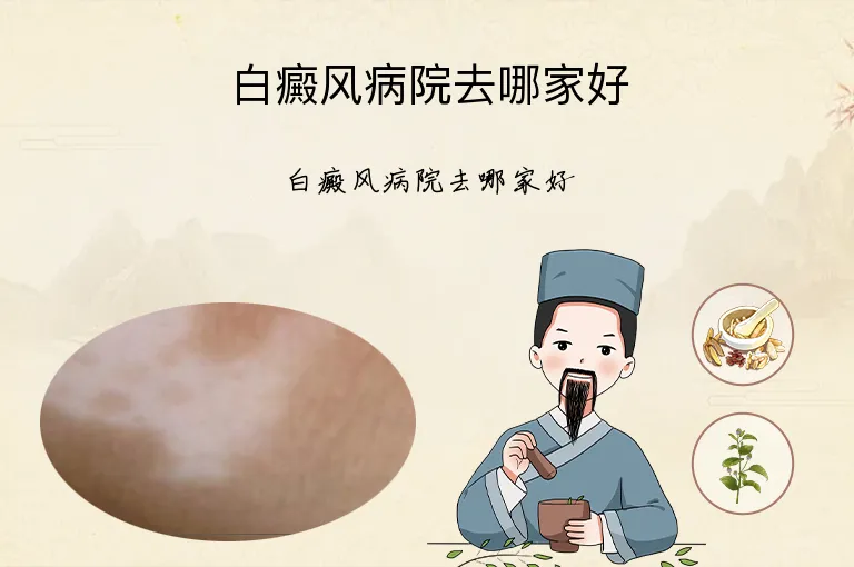 白癜风病院去哪家好