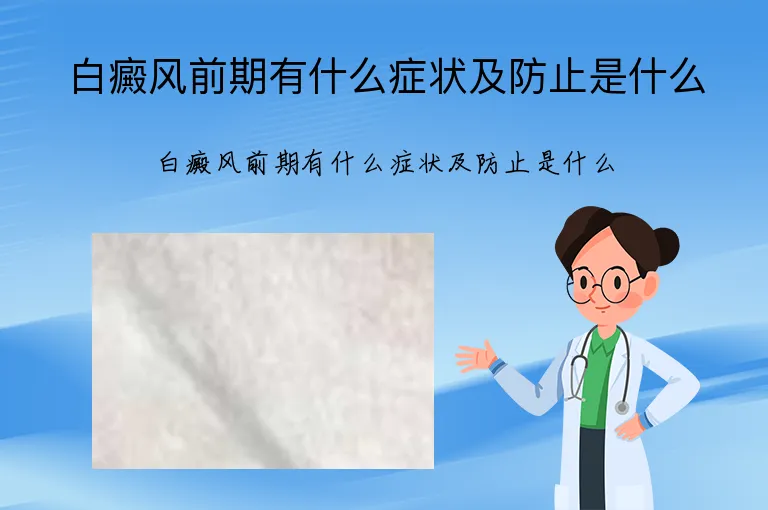 白癜风前期有什么症状及防止是什么