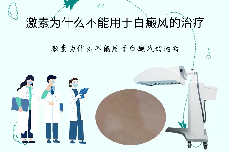 激素为什么不能用于白癜风的治疗