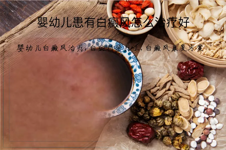 婴幼儿患有白癜风怎么治疗好