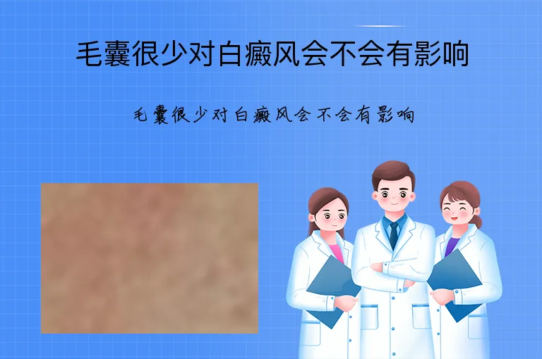 毛囊很少对白癜风会不会有影响