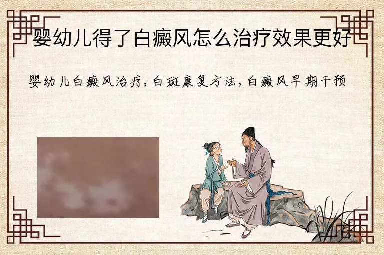 婴幼儿得了白癜风怎么治疗效果更好
