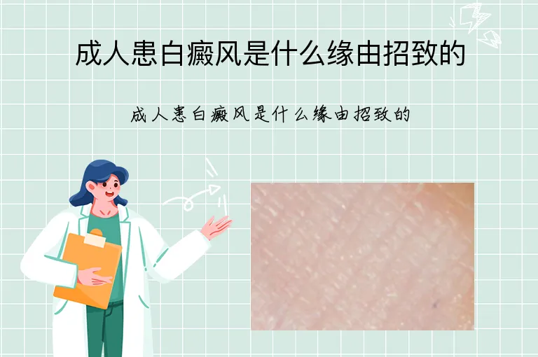 成人患白癜风是什么缘由招致的
