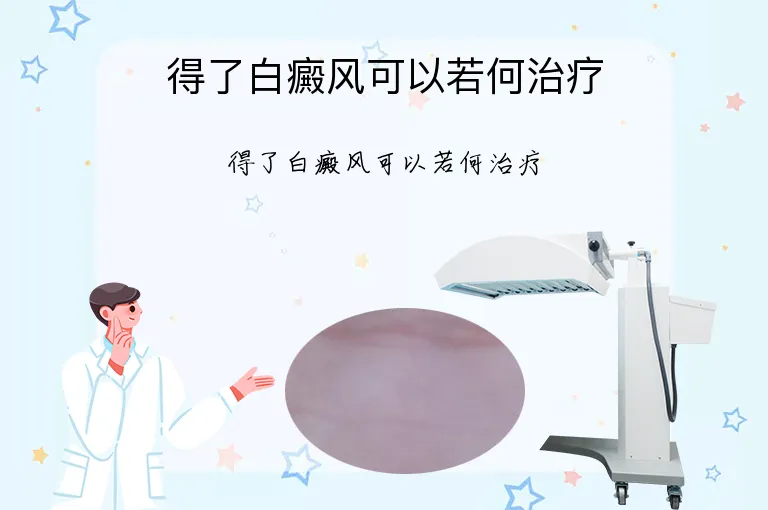 得了白癜风可以若何治疗