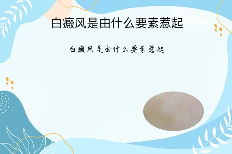 白癜风是由什么要素惹起