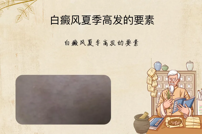 白癜风夏季高发的要素