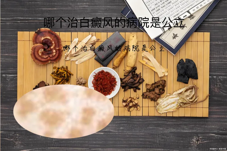 哪个治白癜风的病院是公立
