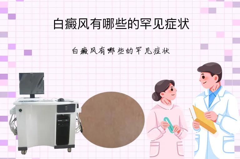 白癜风有哪些的罕见症状
