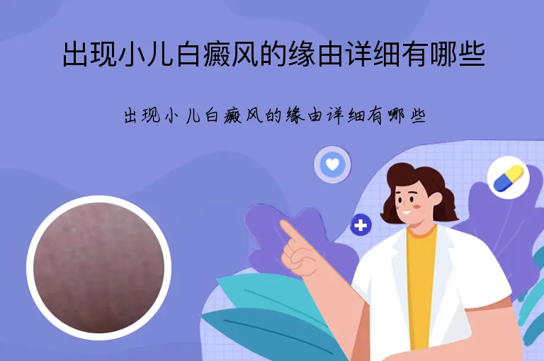 出现小儿白癜风的缘由详细有哪些