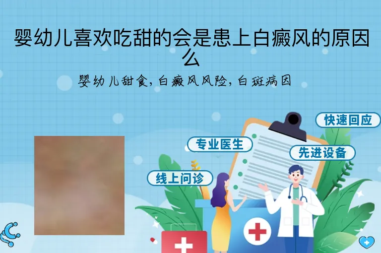 婴幼儿喜欢吃甜的会是患上白癜风的原因么