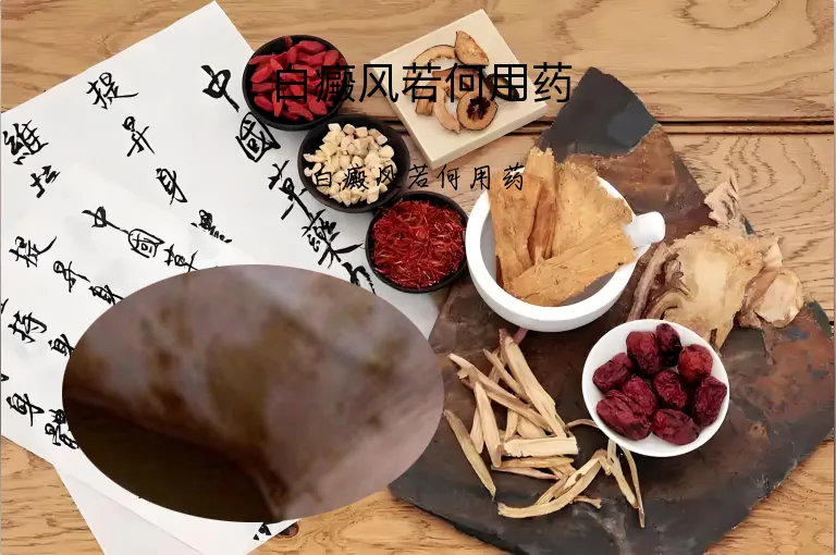 白癜风若何用药