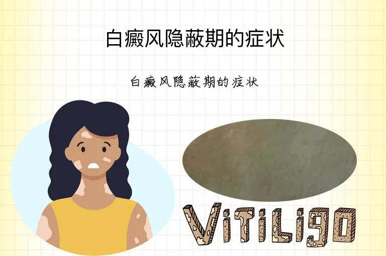 白癜风隐蔽期的症状