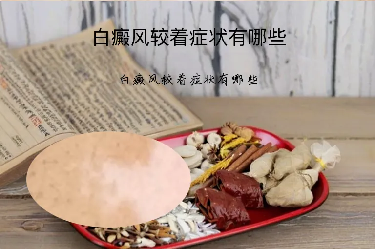 白癜风较着症状有哪些