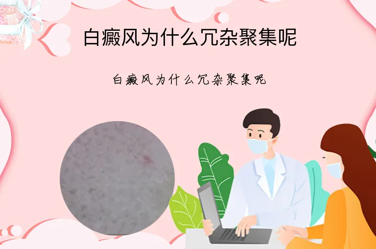 白癜风为什么冗杂聚集呢