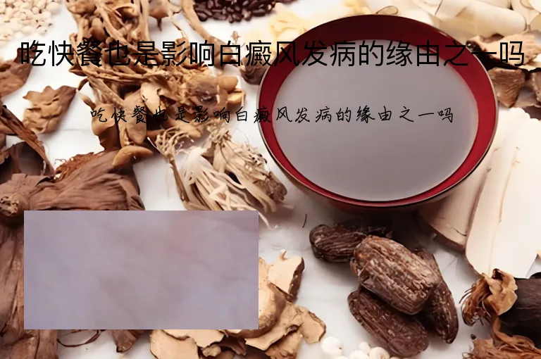 吃快餐也是影响白癜风发病的缘由之一吗