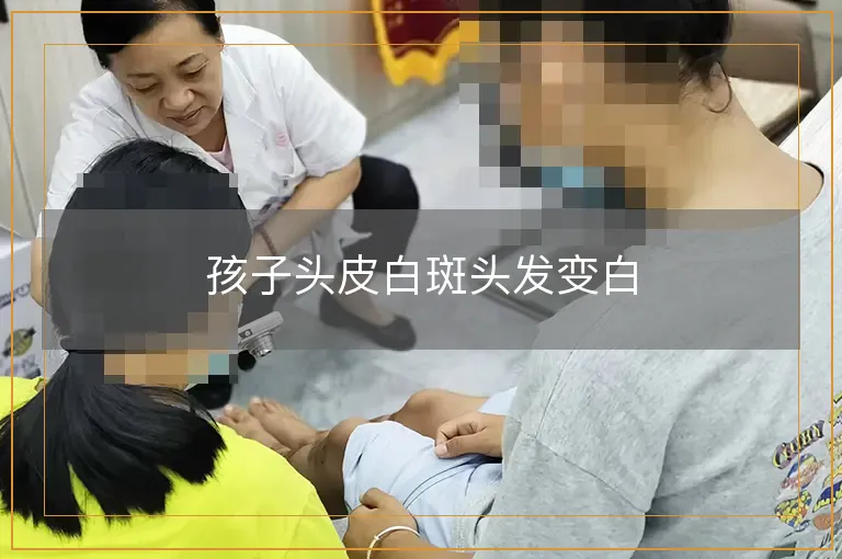 孩子头皮白斑头发变白