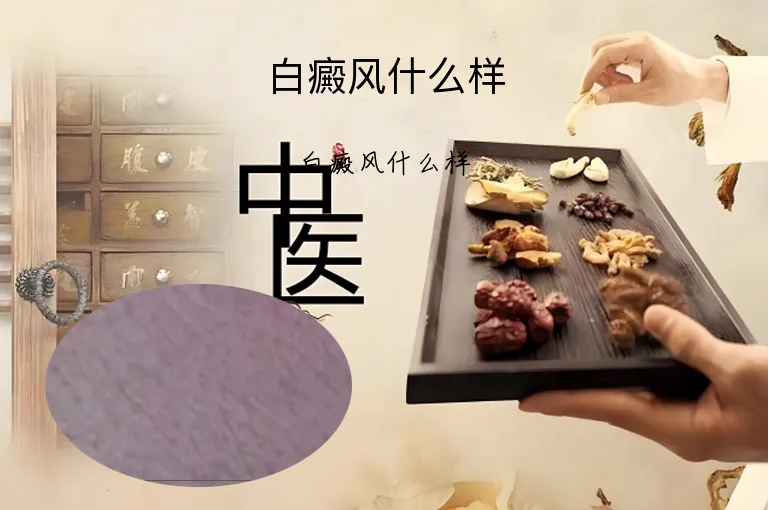 白癜风什么样
