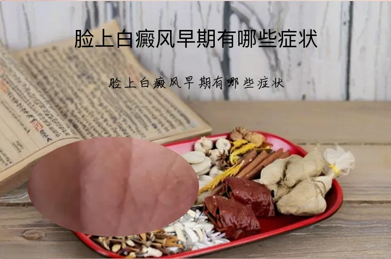 脸上白癜风早期有哪些症状