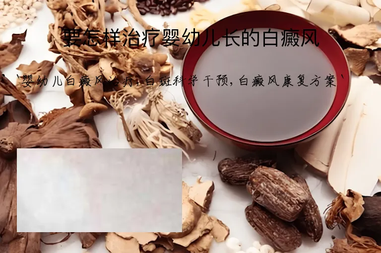 要怎样治疗婴幼儿长的白癜风