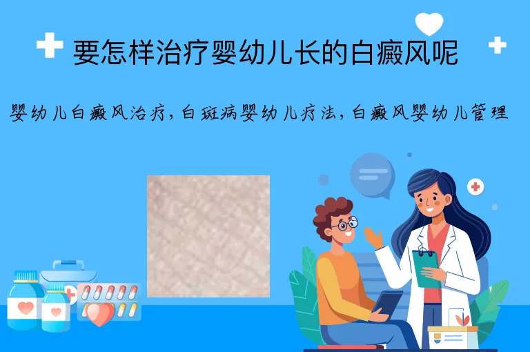 要怎样治疗婴幼儿长的白癜风呢