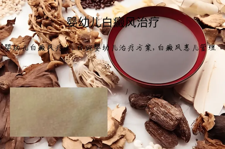 婴幼儿白癜风治疗
