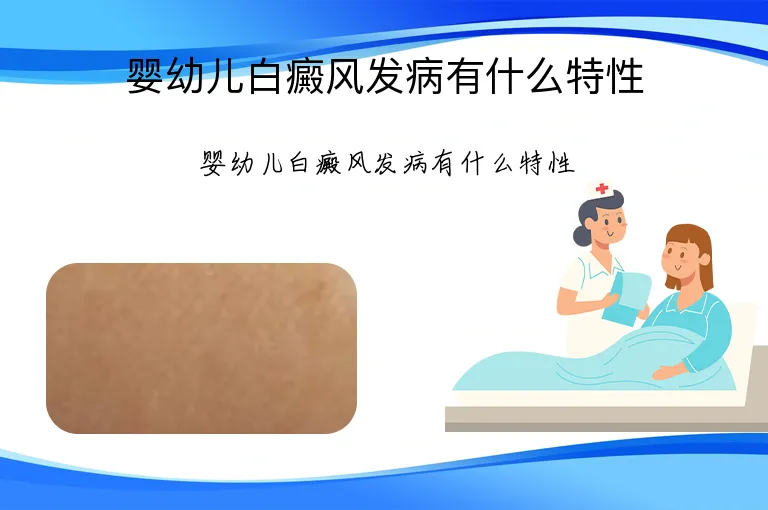 婴幼儿白癜风发病有什么特性