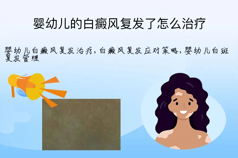 婴幼儿的白癜风复发了怎么治疗