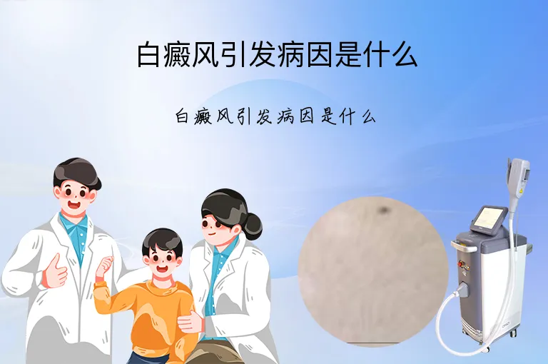 白癜风引发病因是什么