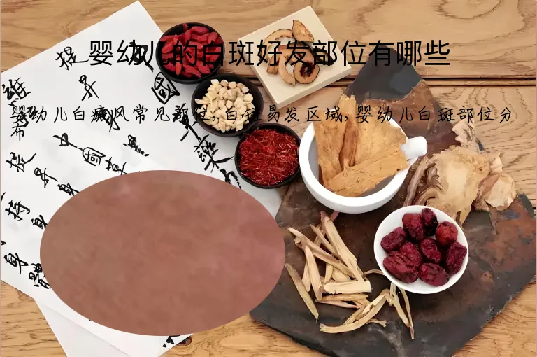 婴幼儿的白斑好发部位有哪些